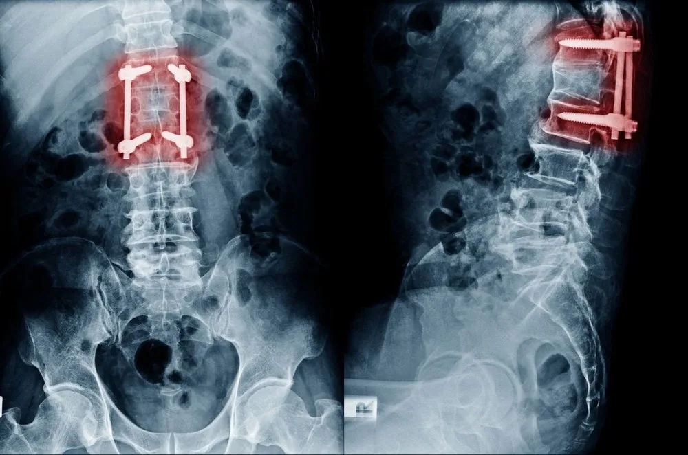 Understanding Degenerative Joint Disease and How to Manage It